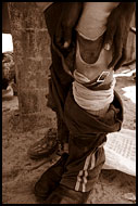 Putting On The Pegleg After Training, Amputee Football Team, Sierra Leone